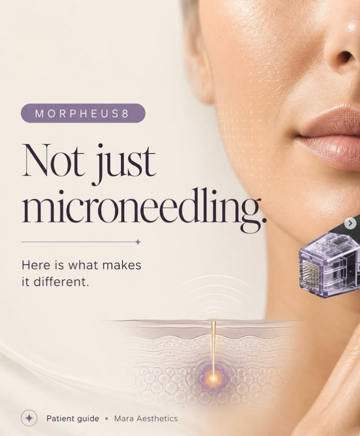 Mara Morpheus 8 Insta